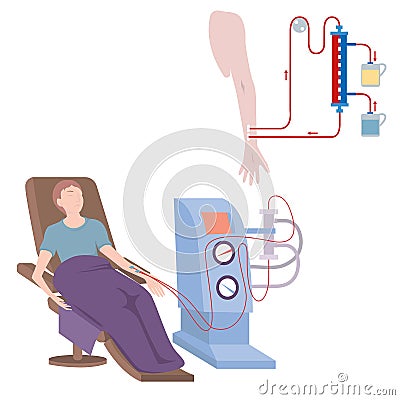 The patient in the chair is connected to the hemodialysis machine. Vector Illustration